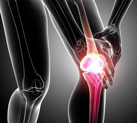 daño a la articulación de la rodilla con artritis y osteoartritis