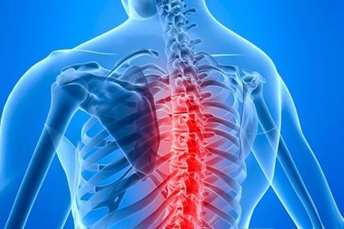 lesión espinal en caso de osteocondrosis torácica