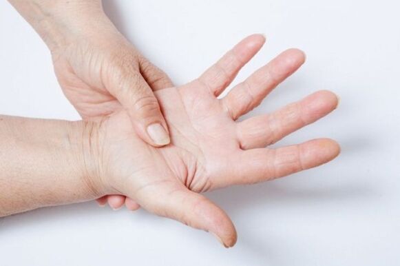 El entumecimiento de la mano es uno de los síntomas de la osteocondrosis lumbar. 