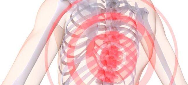 Ubicación del dolor en el condro en el pecho