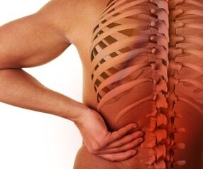 dolor de espalda con osteocondrosis lumbar