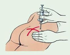 inyección para el tratamiento de la osteocondrosis