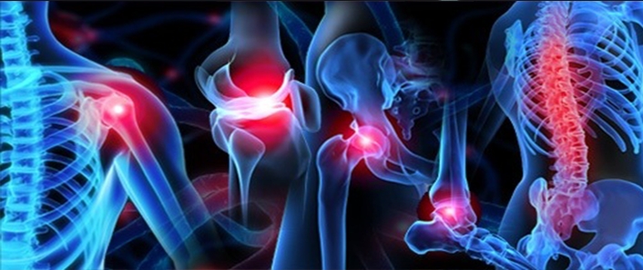 Lesiones articulares